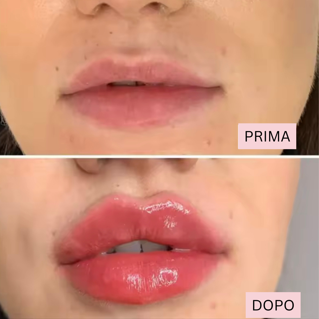 Gloss Volumizzante Labbra